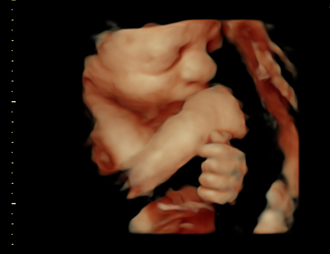 3d sonogram image at HD weeks