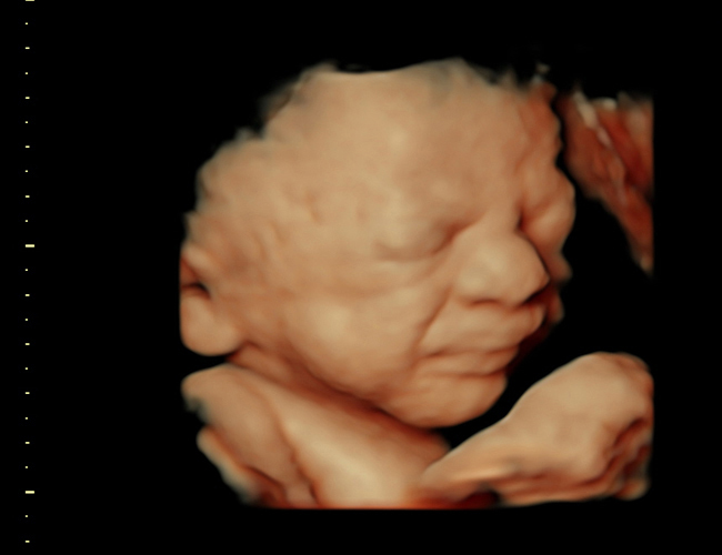 3d sonogram image at HD weeks