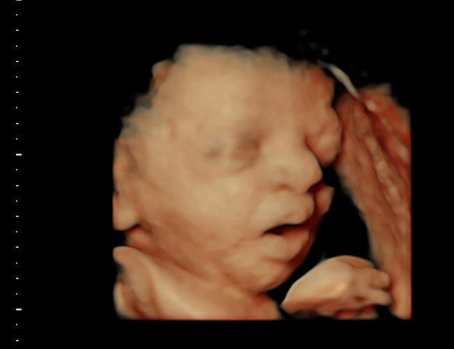 3d sonogram image at HD weeks