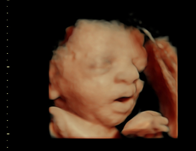 3d sonogram image at HD weeks