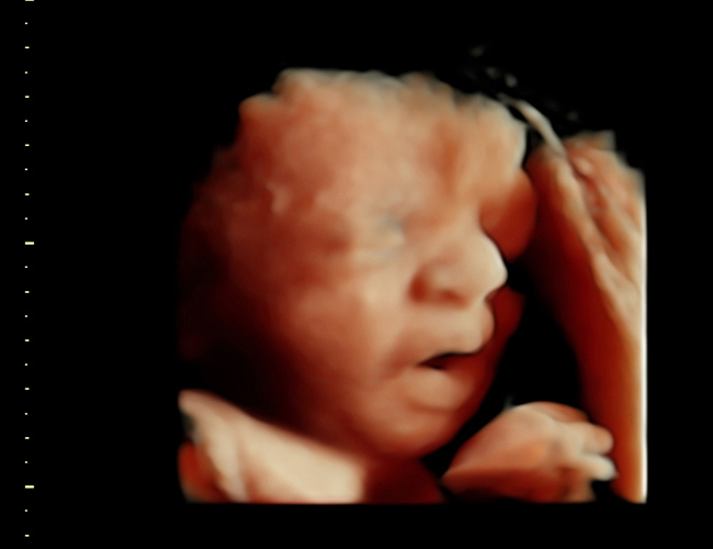 3d sonogram image at HD weeks