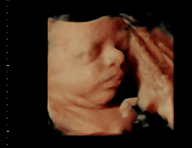 3d sonogram image at HD weeks