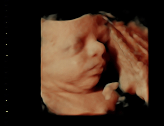 3d sonogram image at HD weeks