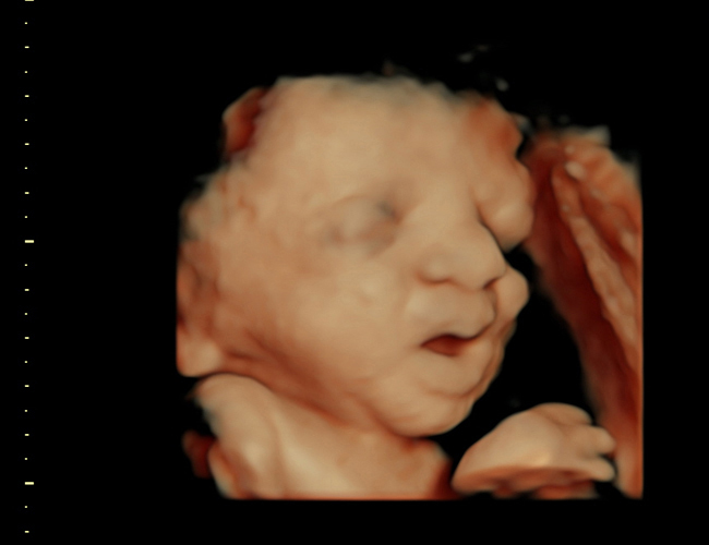 3d sonogram image at HD weeks