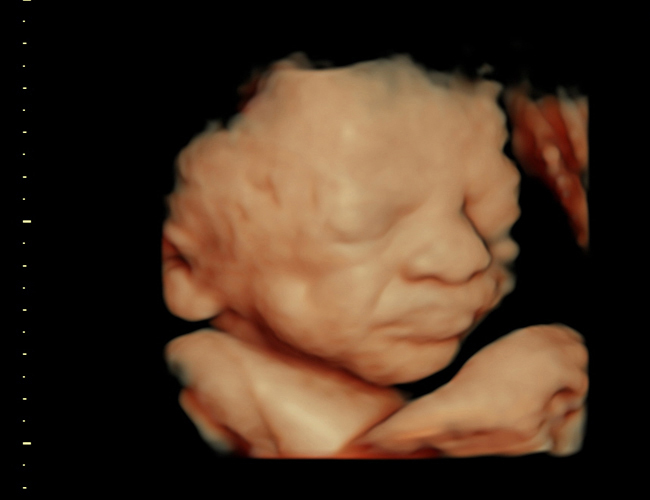 3d sonogram image at HD weeks