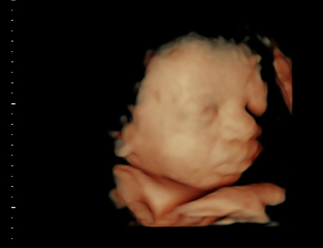 3d sonogram image at HD weeks