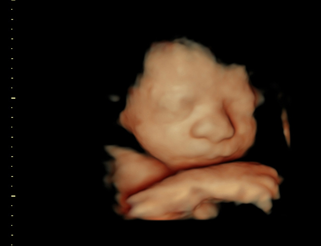 3d sonogram image at HD weeks