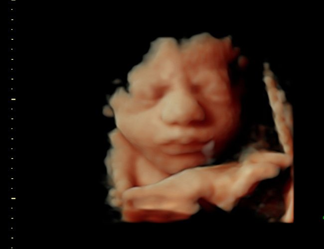 3d sonogram image at HD weeks