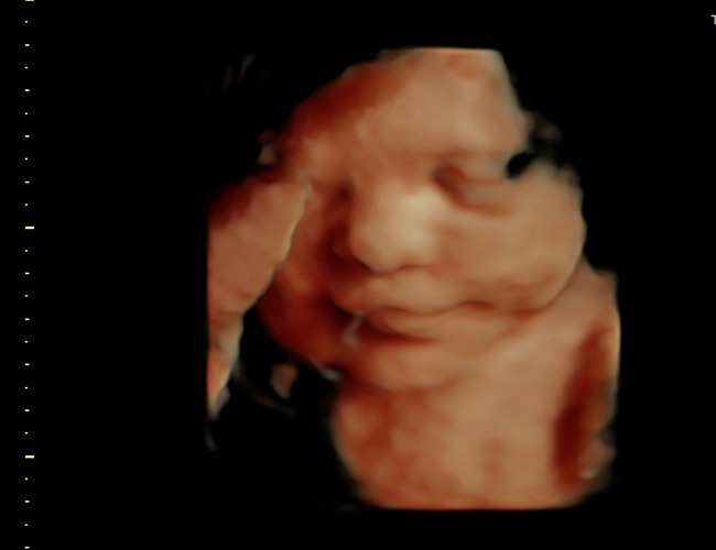 3d sonogram image at HD weeks