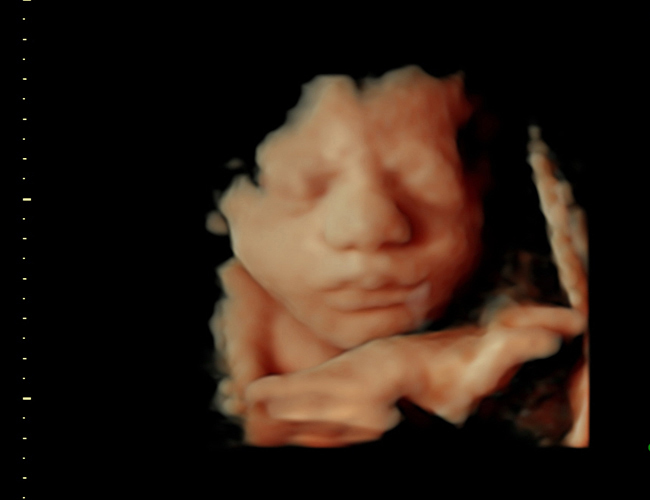 3d sonogram image at HD weeks