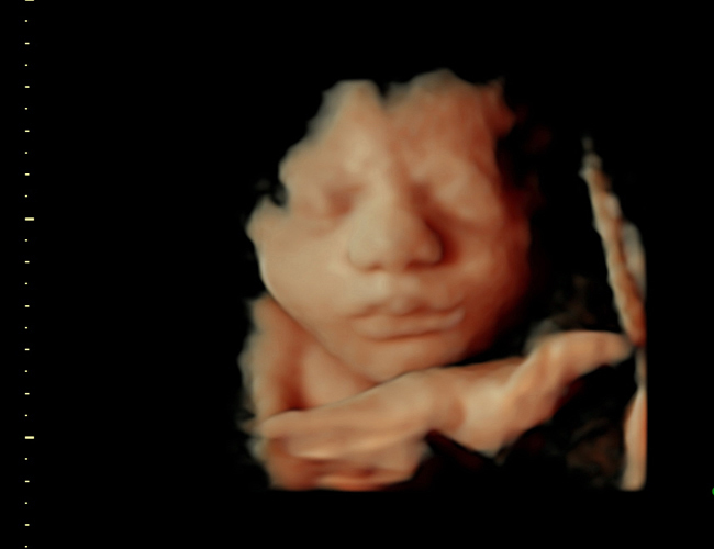 3d sonogram image at HD weeks