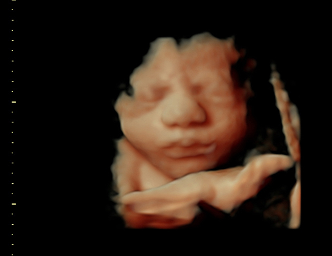 3d sonogram image at HD weeks