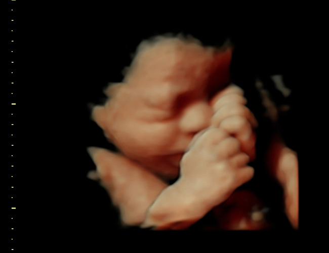 3d sonogram image at HD weeks