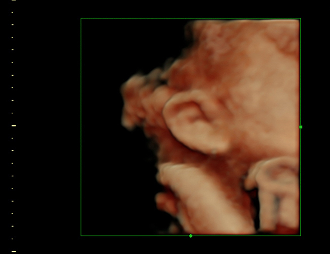 3d sonogram image at HD weeks